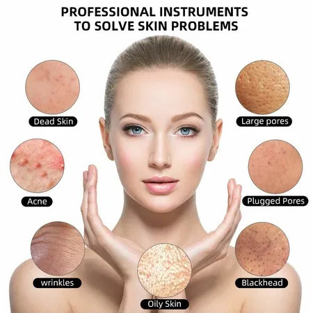 Supreme UltrasonicGlow™ |  Uw persoonlijke faceliftoplossing en huidreiniger!