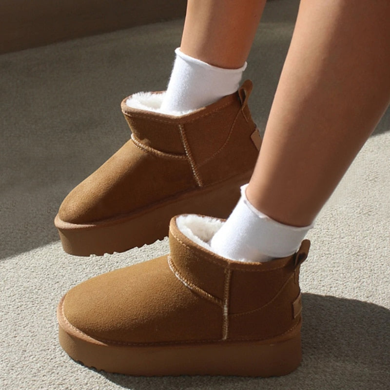 Supreme Uggies ™ | Uw ultieme stijl en comfort metgezel voor het seizoen