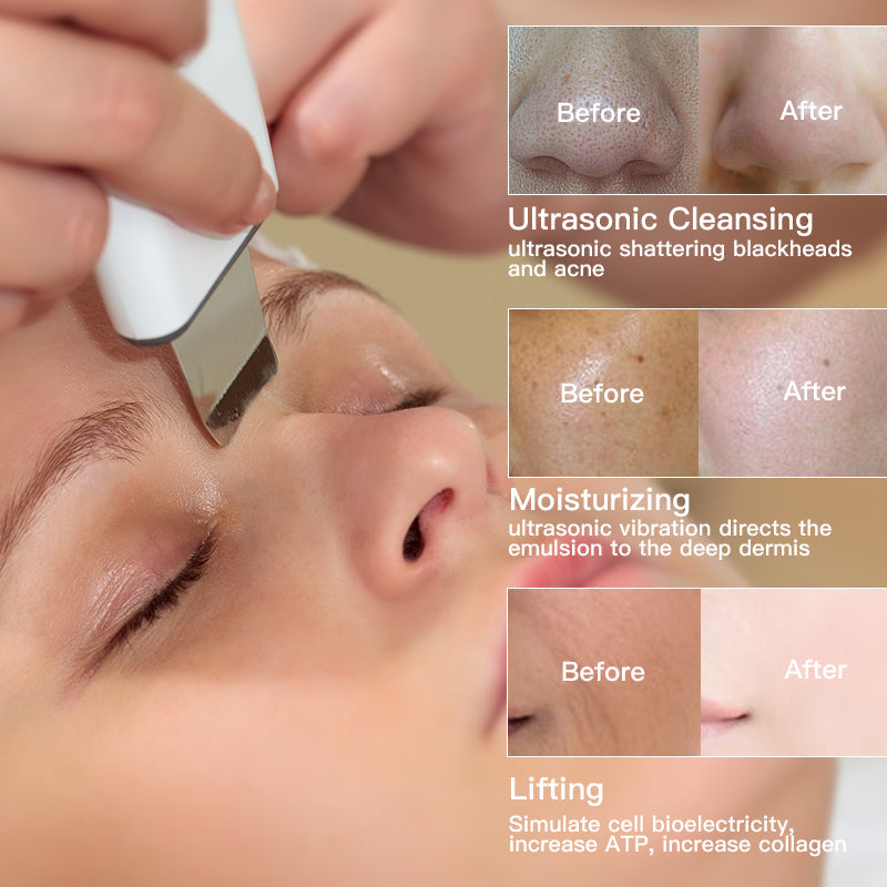 Supreme UltrasonicGlow™ |  Uw persoonlijke faceliftoplossing en huidreiniger!