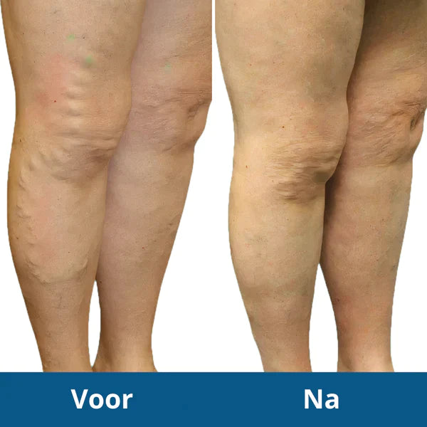 Supreme FootPulse™ Behandel pijnklachten, en stimuleer vetverbranding!
