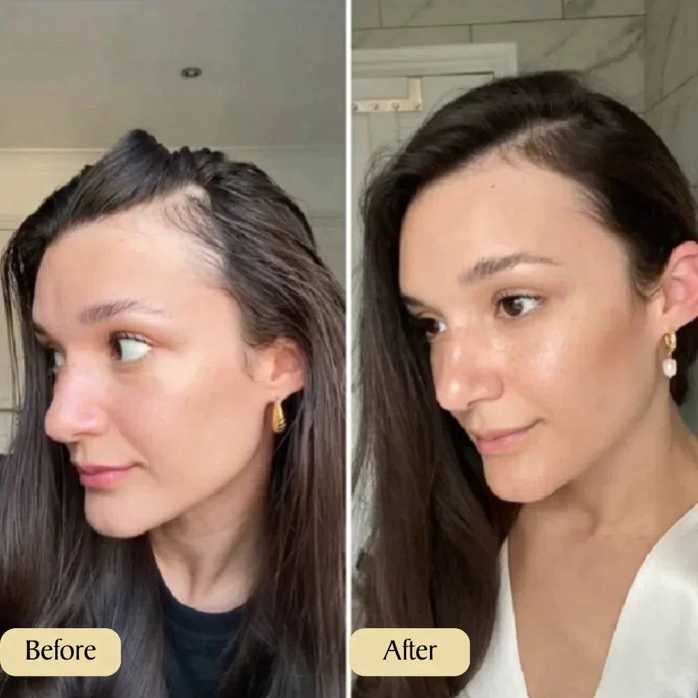 Supreme Carvenchy™ Haar olie 1+1 GRATIS!  Jouw natuurlijke oliebehandeling voor haargroei