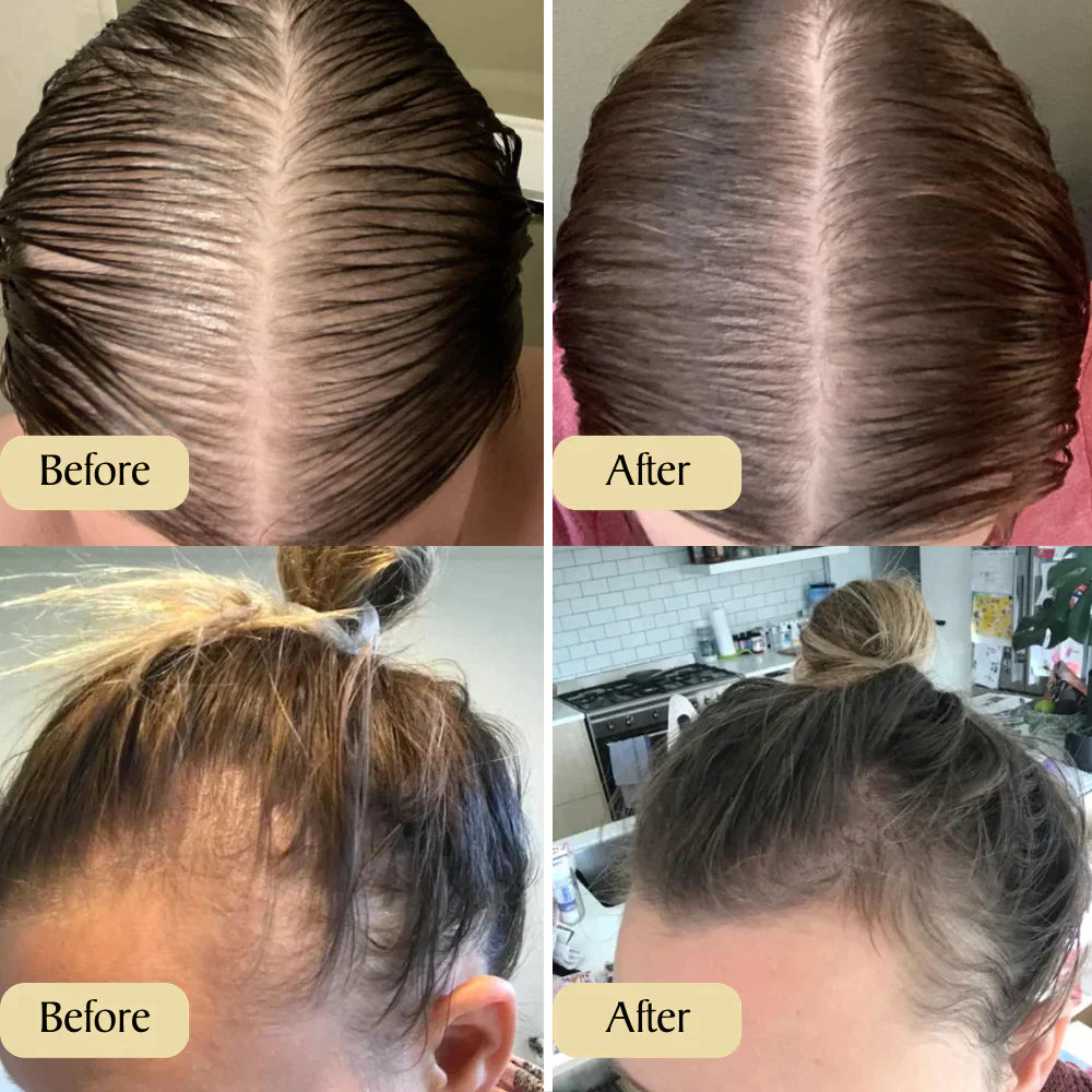 Supreme Carvenchy™ Haar olie 1+1 GRATIS!  Jouw natuurlijke oliebehandeling voor haargroei
