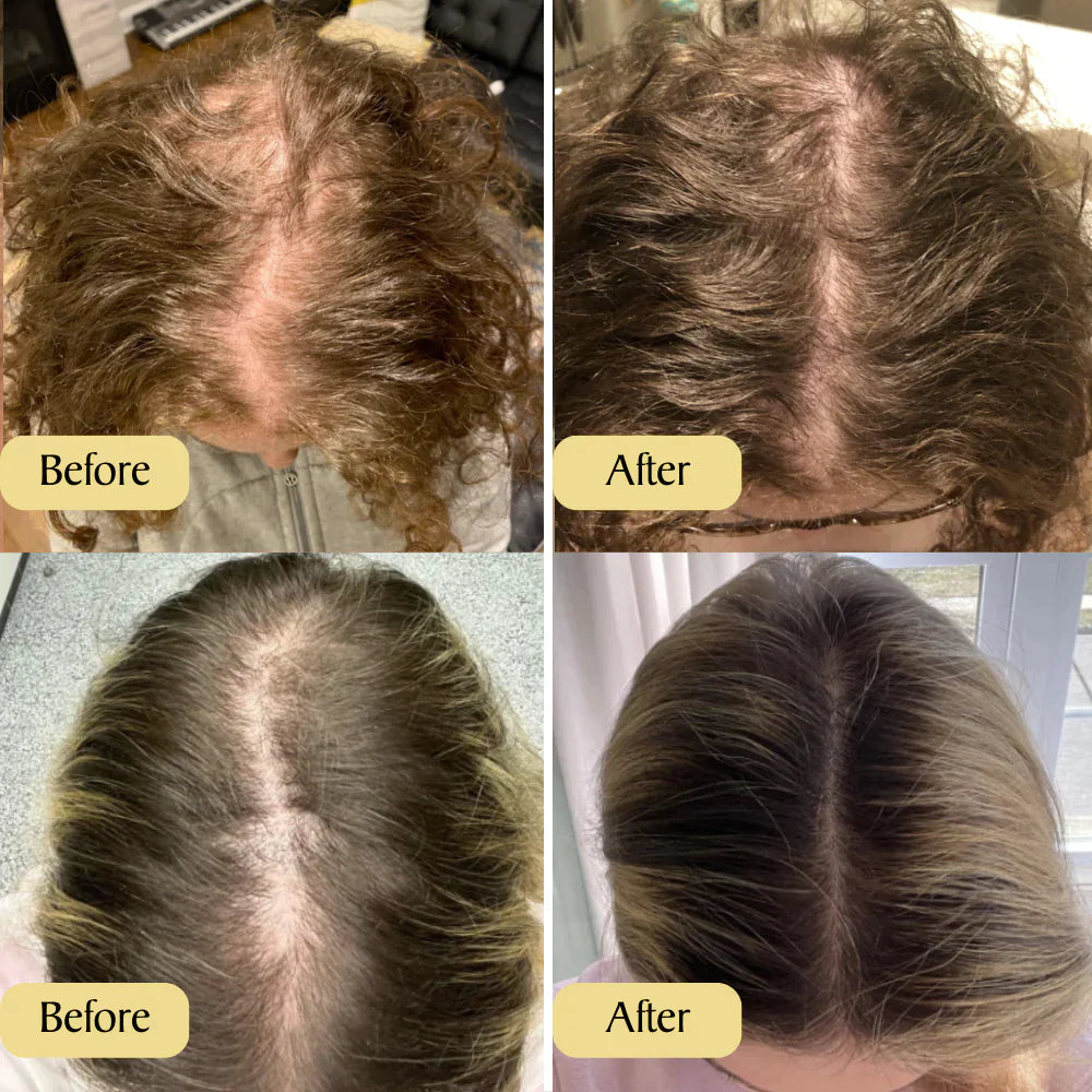Supreme Carvenchy™ Haar olie 1+1 GRATIS!  Jouw natuurlijke oliebehandeling voor haargroei